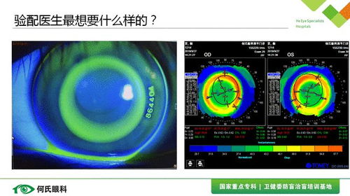 干货 角膜塑形镜常规问题处理